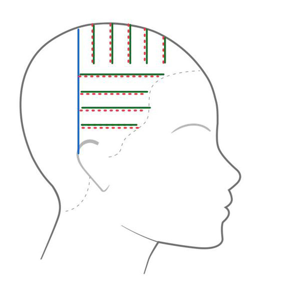 Dimensional Foiling - applying root melt formula
